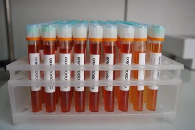 Laboratory sample tubes used to illustrate health tracking